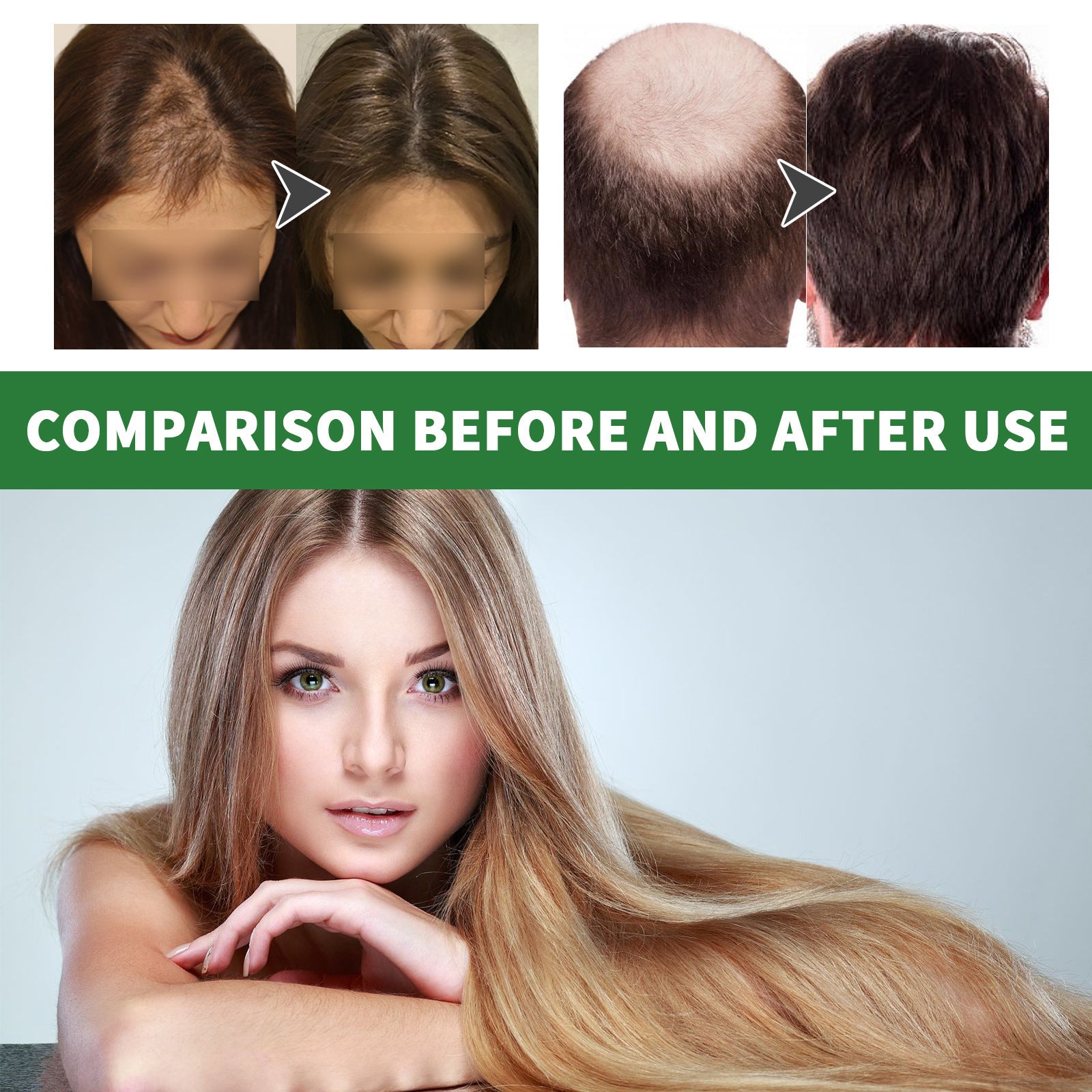 OUHOE™ Rosemary Hair Growth Oil – Strengthening & Nourishing Hair Serum (30 ml)