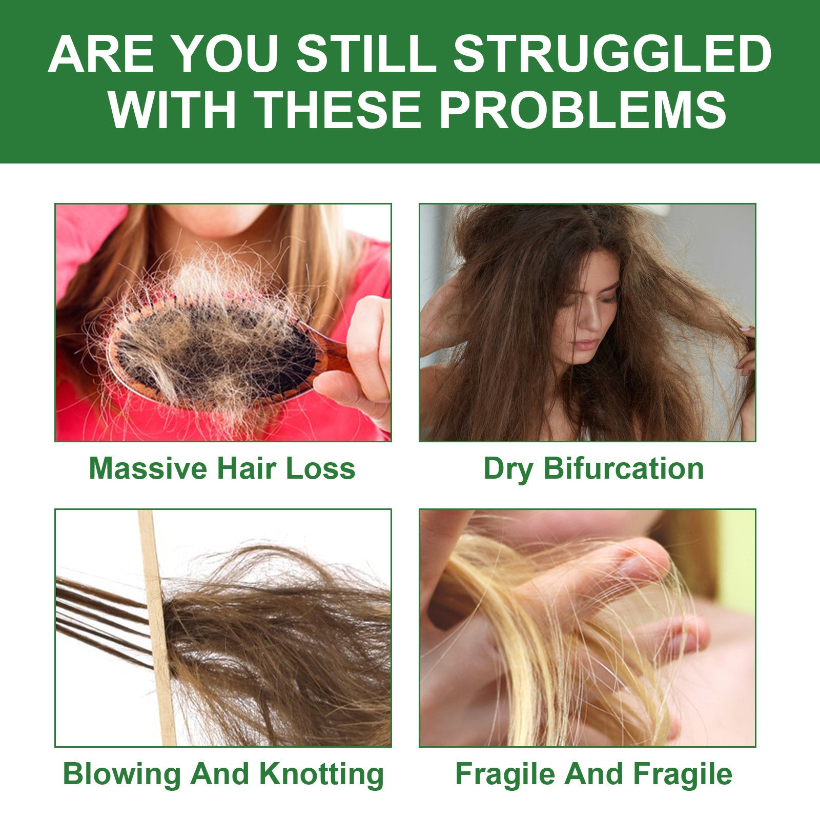 OUHOE™ Rosemary Hair Growth Oil – Strengthening & Nourishing Hair Serum (30 ml)